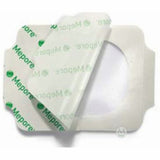 Molnlycke 273000 Mepore Transparent Film Dressing-50/Case